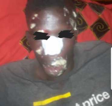 Une intervention chirurgicale  pour Abdulkarim