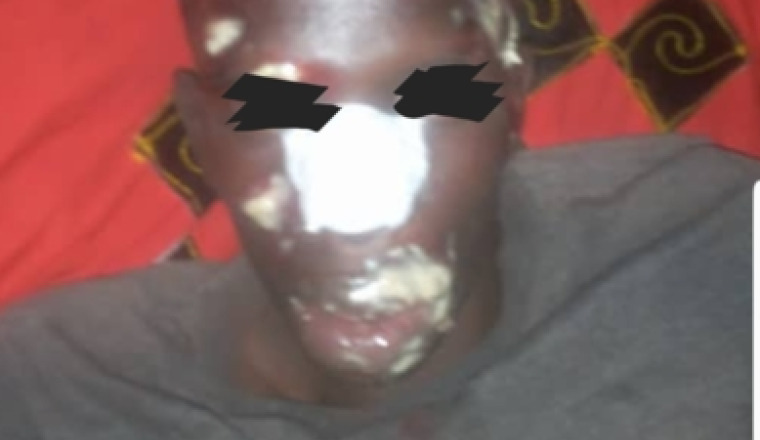 Une intervention chirurgicale  pour Abdulkarim