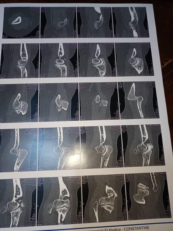 Fundraising proof image