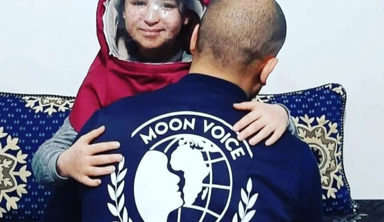 Soutenons les enfants de la lune au Maroc !