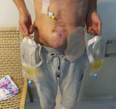Aidons Kamel à combattre son cancer
