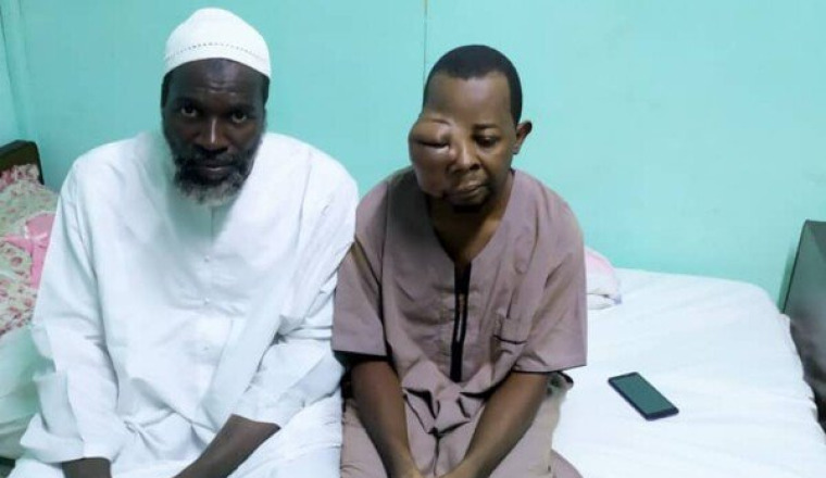 aider frère youssouf atteint d’une tumeur faciale