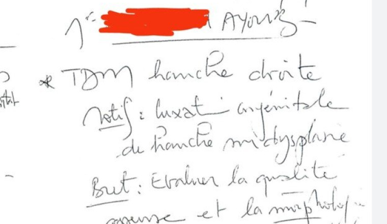 Opération Arthroplastie jeune homme 21 ans