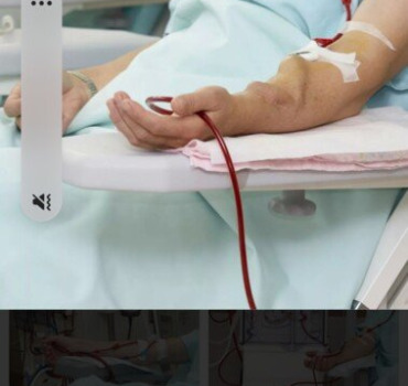 Dialyses