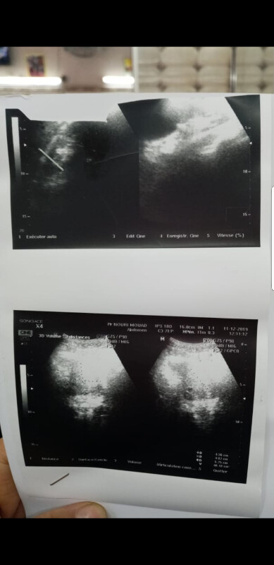 Fundraising proof image