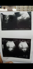 Fundraising proof image