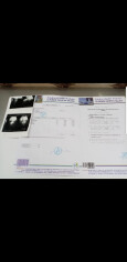 Fundraising proof image
