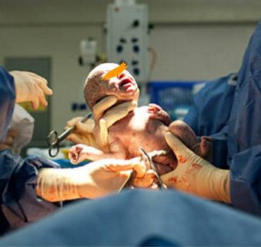 Une 3 ème césarienne pour une maman en urgence