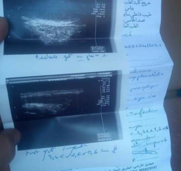 Operation urgente enfant de 13 ans