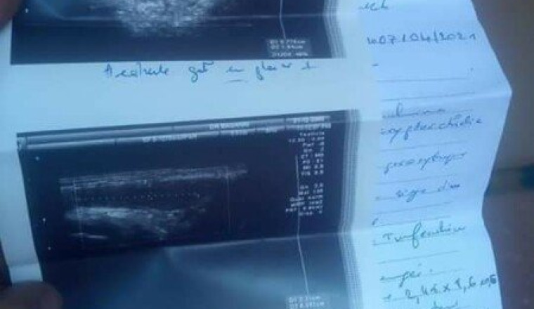Operation urgente enfant de 13 ans
