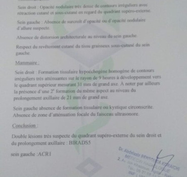 Aidons Aïcha à soigner son cancer du sein