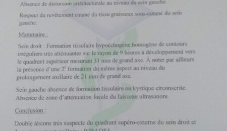 Aidons Aïcha à soigner son cancer du sein