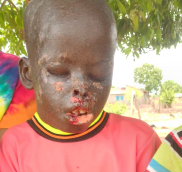 OPÉRATION VITALE POUR ENFANT AU SÉNÉGAL