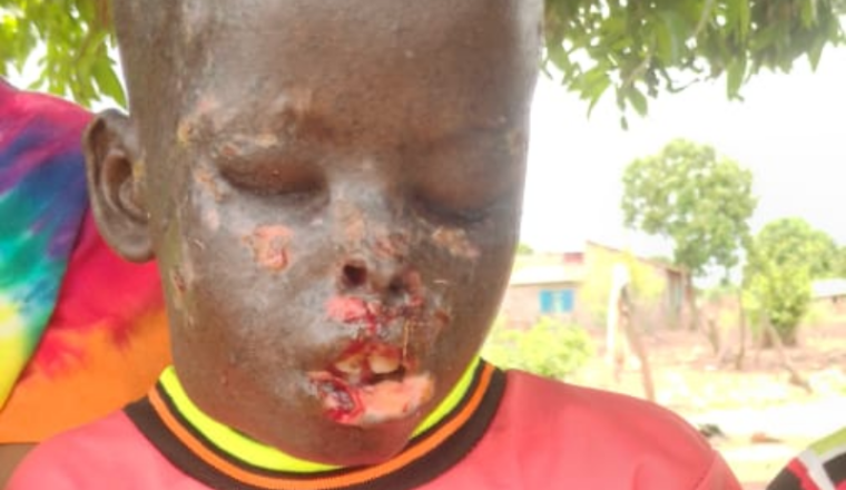 OPÉRATION VITALE POUR ENFANT AU SÉNÉGAL