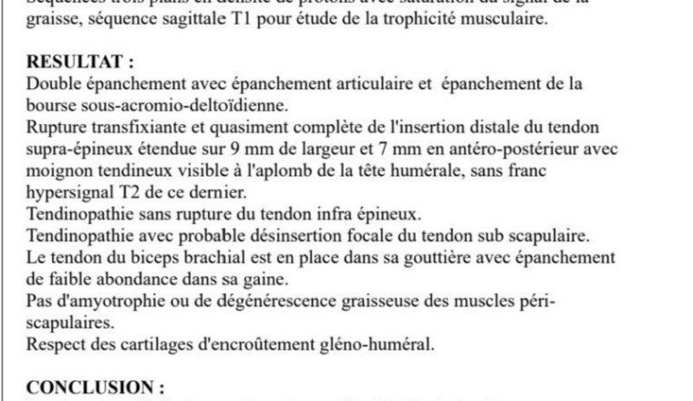 Aidez Notre frère à se faire opérer en urgence