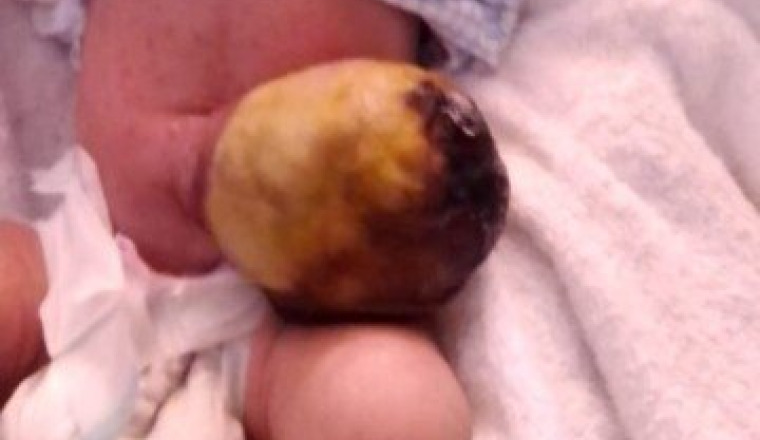 Sadaqa santé: bébé