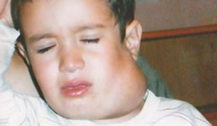 Une intervention pour nassim