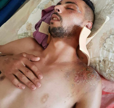 Aidons oussama à retrouvé sa mobilité