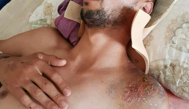 Aidons oussama à retrouvé sa mobilité