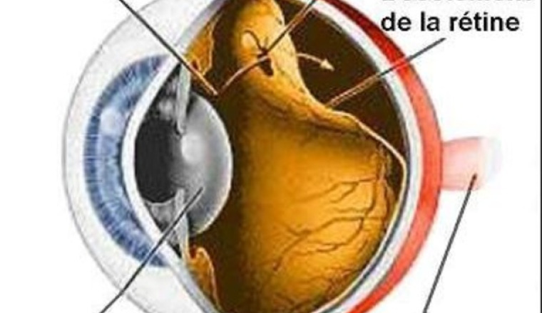 Gravement malade, ZAID a besoin de vous