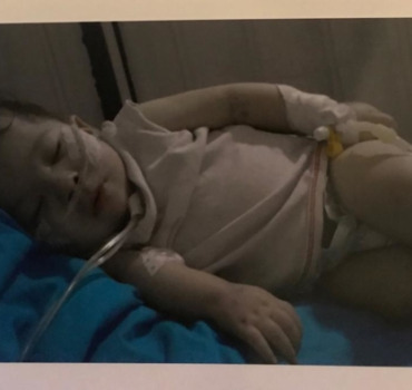 Malformation du petit Mohamed