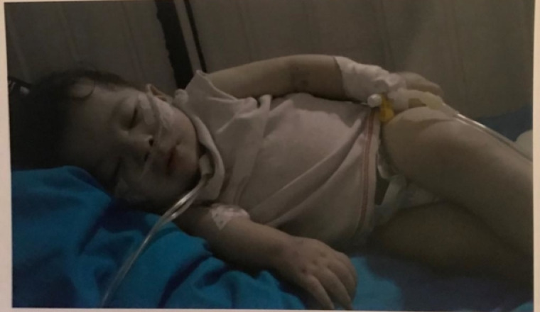 Malformation du petit Mohamed