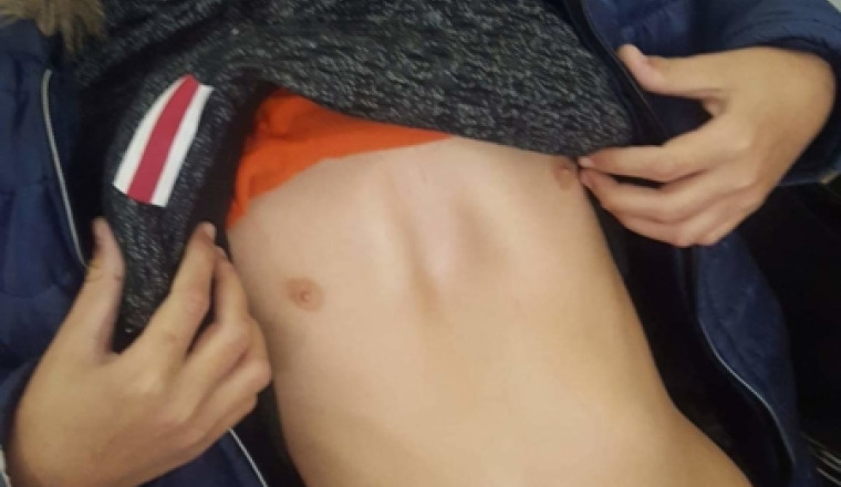 Urgence LOKMANE 15 ANS