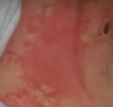 Aidons une mamie tunisienne ! (URGENCE)
