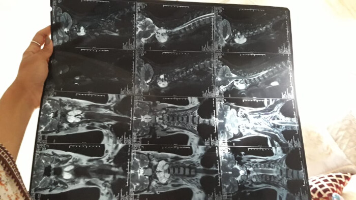 Fundraising proof image