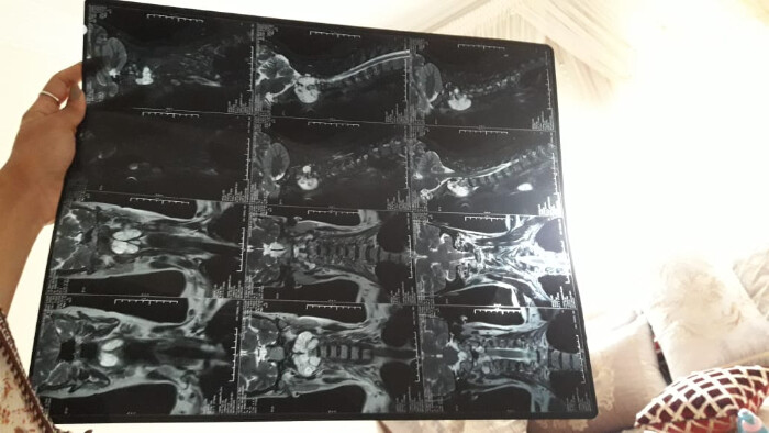 Fundraising proof image