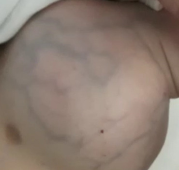 AIDONS CE BÉBÉ DE 8 MOIS A VAINCRE SON CANCER !