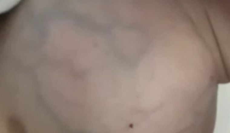 AIDONS CE BÉBÉ DE 8 MOIS A VAINCRE SON CANCER !