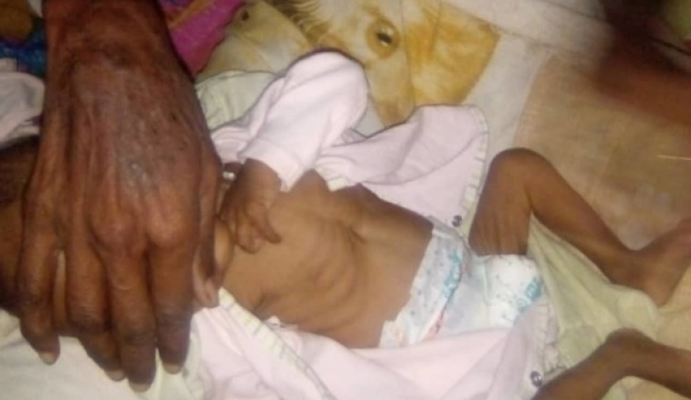 Aidez nous à sauver le bébé Afsa en urgence vitale