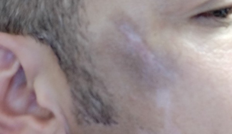 Retrouvez un beau visage pour retrouver une vie