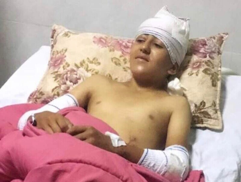 Le petit Yuliwas victime d'un accident de travail