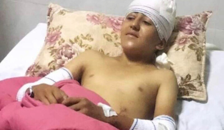 Le petit Yuliwas victime d'un accident de travail