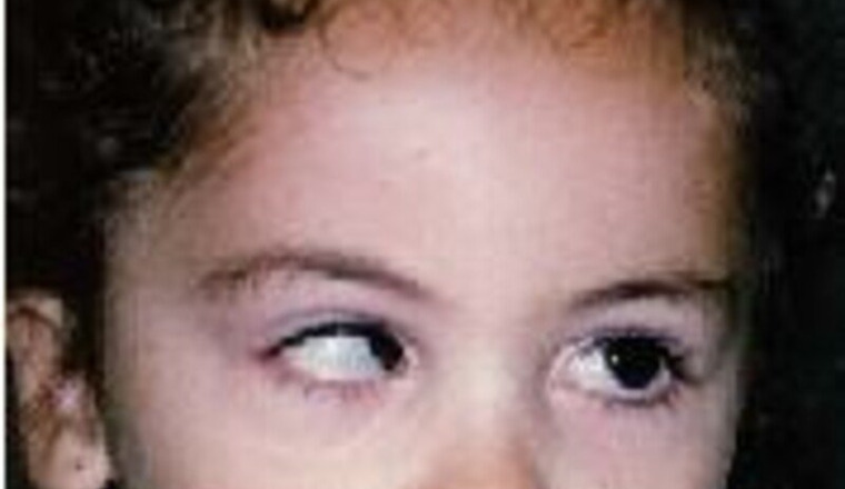 Opération des yeux enfant au Maroc
