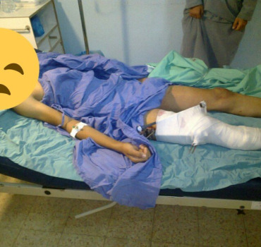 Une nouvelle prothèse pour Mahmoud