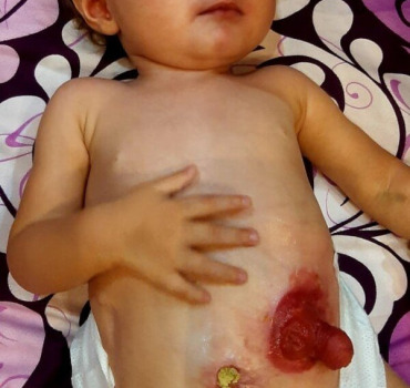 Ma niece IKRAM âgée de 14 mois besoin d'aide