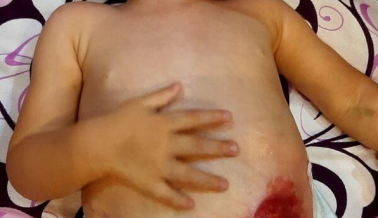 Ma niece IKRAM âgée de 14 mois besoin d'aide