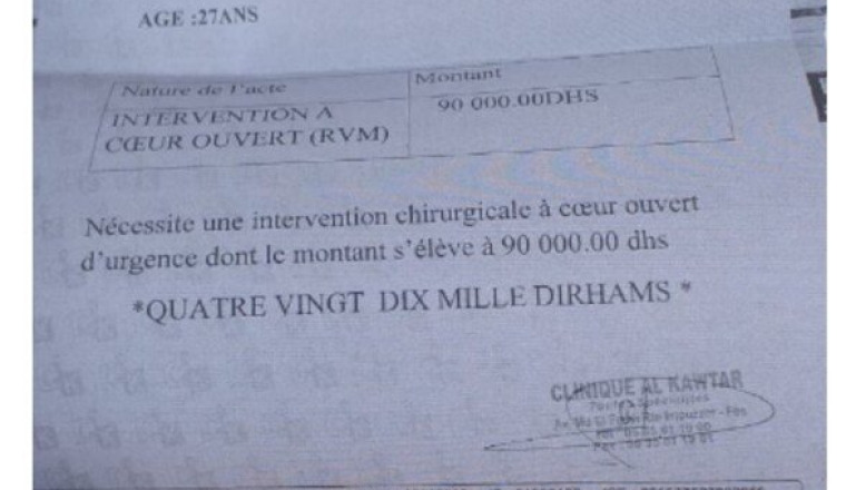 Opération coeur et suite operatoire