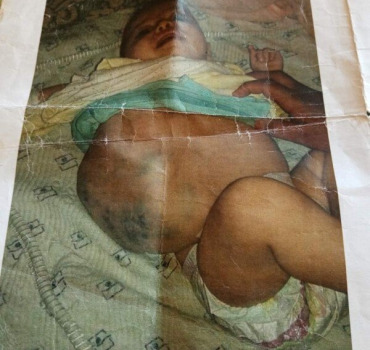 Aidons la petite meryem