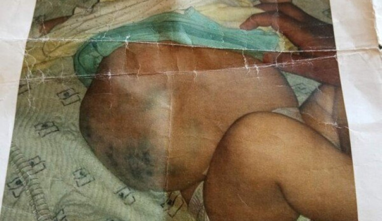 Aidons la petite meryem