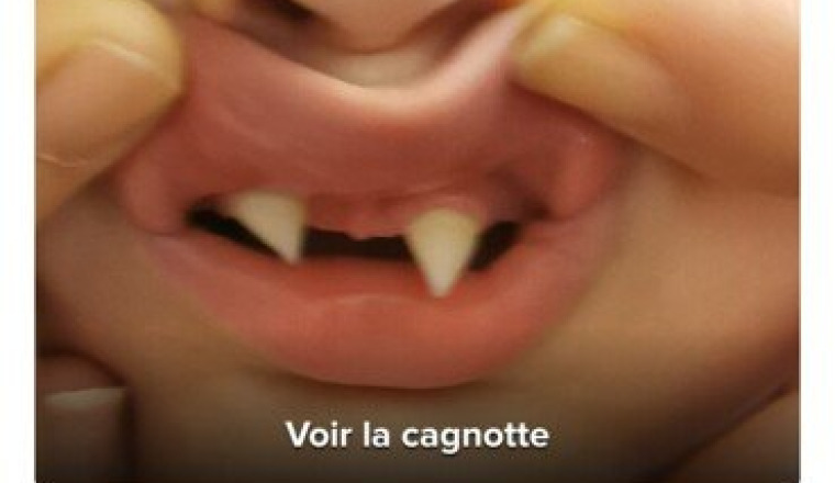 Appareillage
