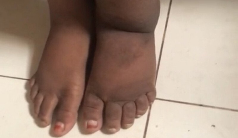 SOS POUR FATOUMATA DIOULDÉ DIALLO
