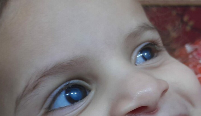 Aide/help Sana's (2.5) eyes/ operations des yeux