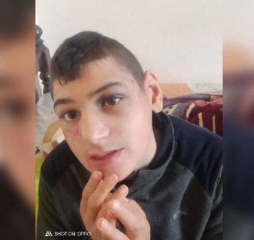 Une craniectomie pour Rayane