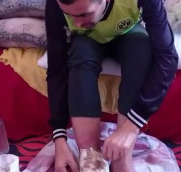 Aider hassan à vivre sans douleur