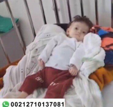 Chirurgie cardiaque urgente pour un garçon 9 mois.
