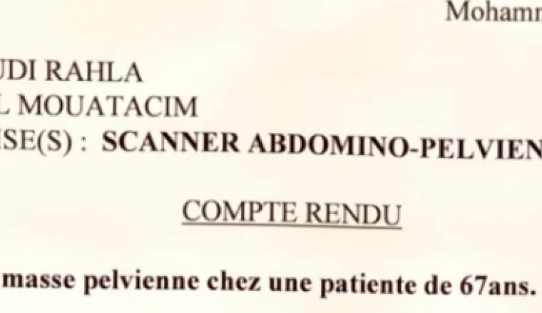Chimio pour RAHLA